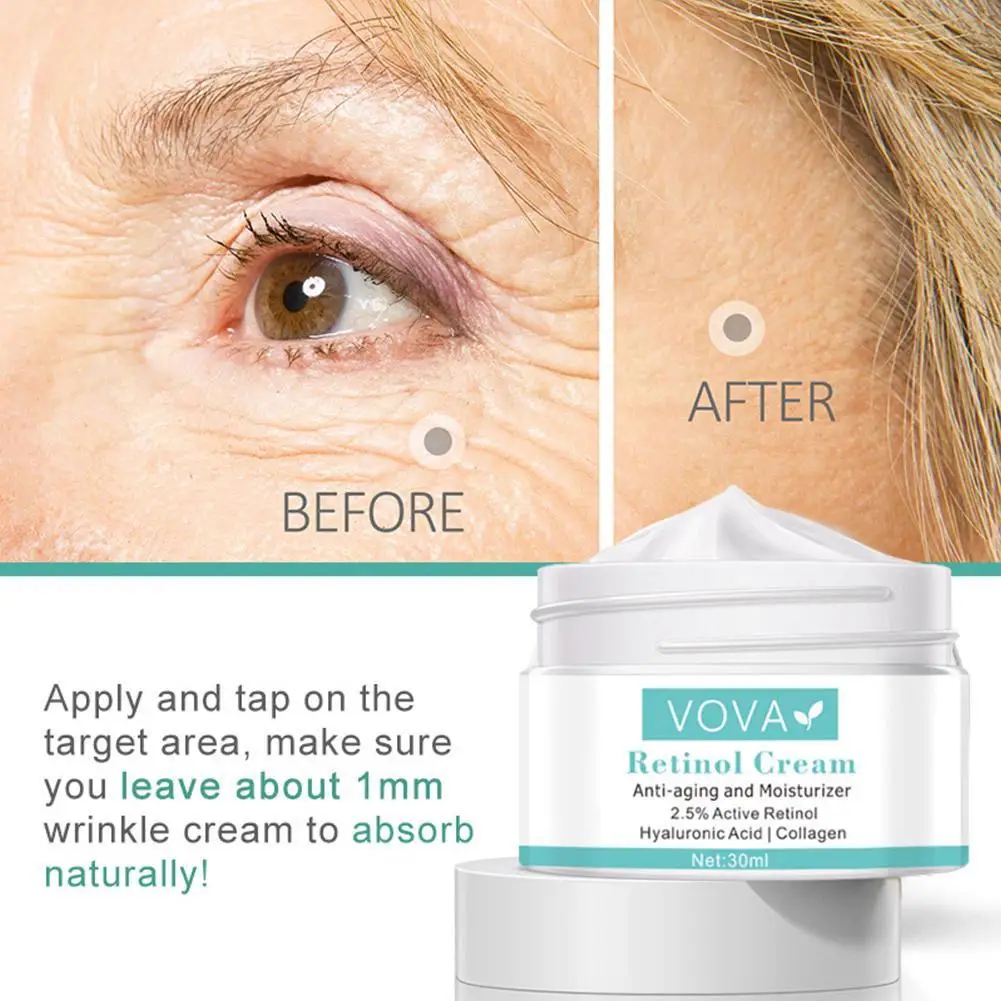 crema de ochi anti-imbatranire pentru 20 de viteze înfrumuseța complexul anti-îmbătrânire